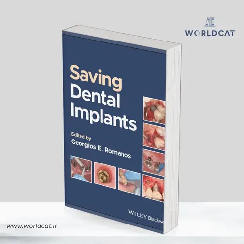 جلد کتاب کتاب Saving Dental Implants